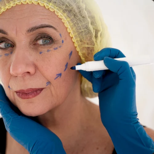 Toxina Botulínica (Botox)